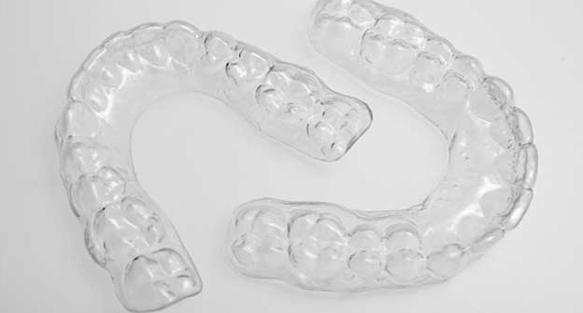 Clear Retainers