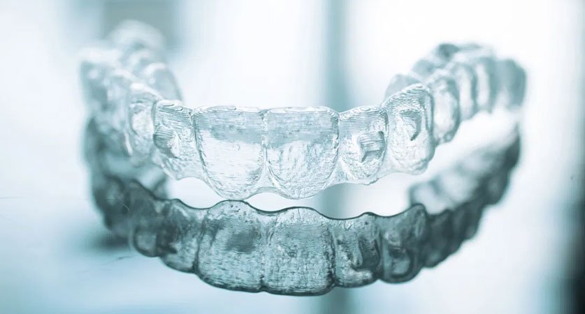 Invisalign cost