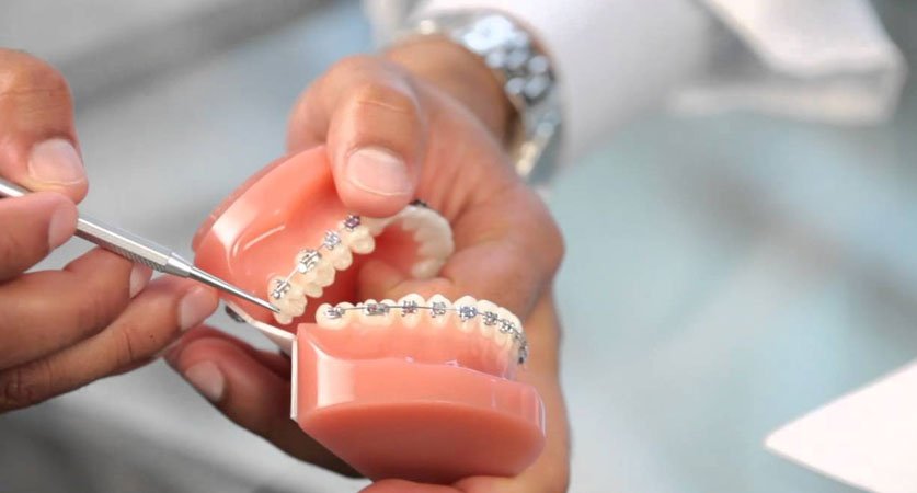 top rated orthodontist near me