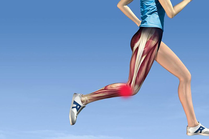 Iliotibial Band Syndrome