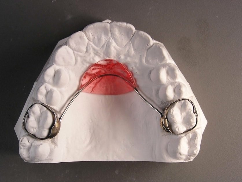 partial denture