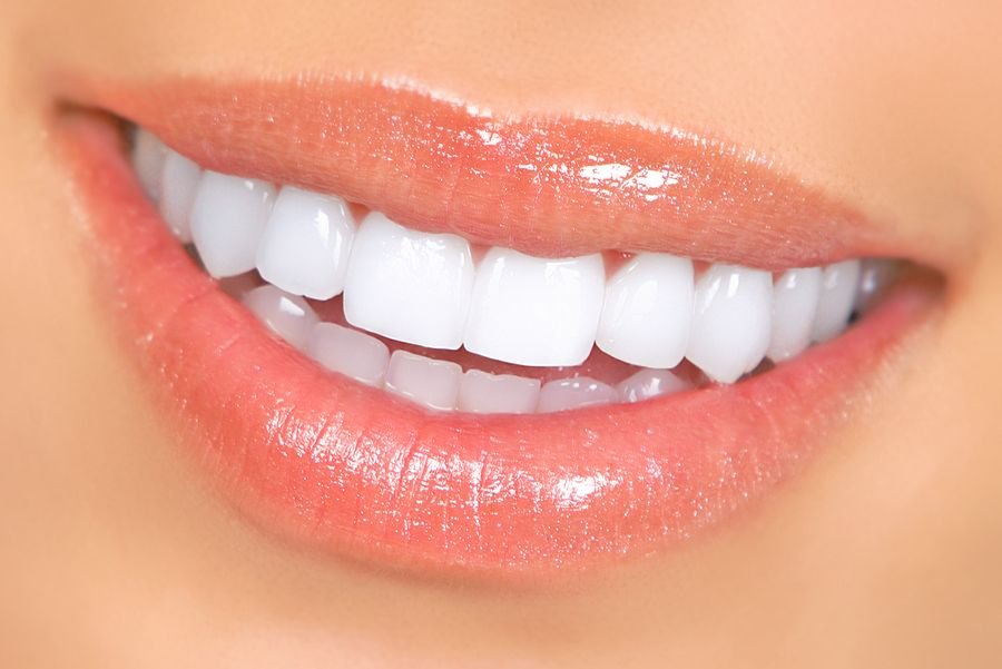 veneers specialist