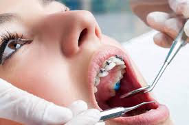 Miami orthodontist