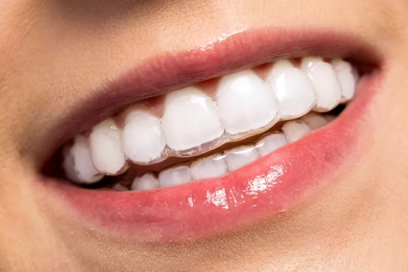 Metlife Cover Invisalign