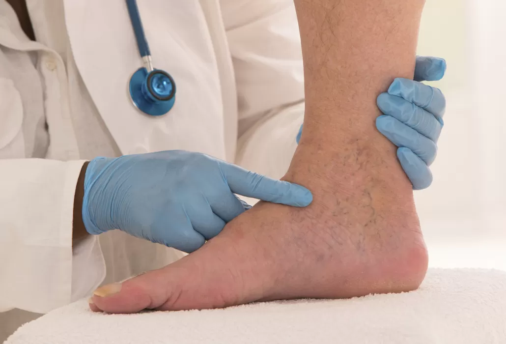 when to see a Vascular Doctor