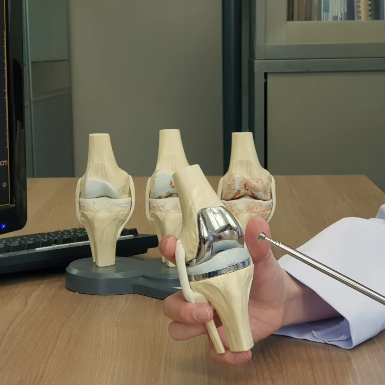 Fracture treatment in Bilaspur