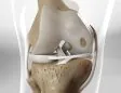tre_image